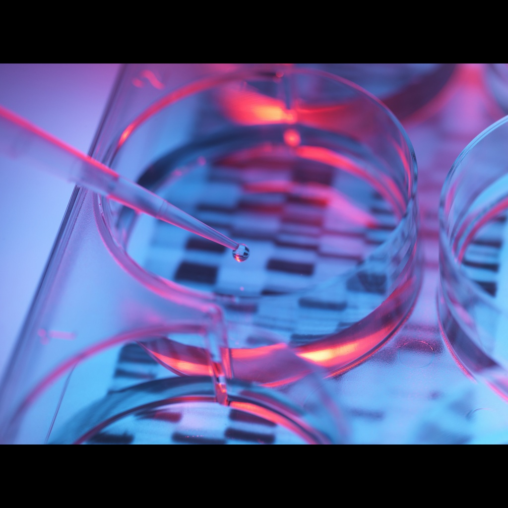 CEACAM5 ORF Vector  Human   pORF size:1.0 µg DNA